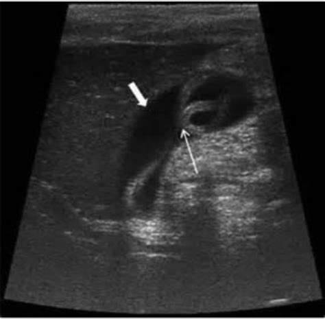 <b>Vascular</b> <b>ultrasound</b> <b>registry</b> <b>review</b> study materials. . Vascular ultrasound registry review quizlet